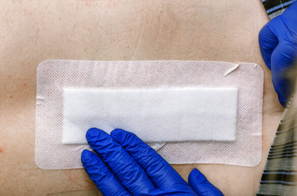 TRATAMENT ESCARE LA DOMICILIU